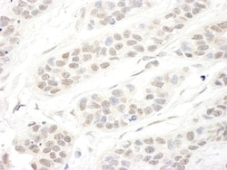 SET1B Antibody, Novus Biologicals 0.1mg; Unlabeled:Antibodies, Polyclonal